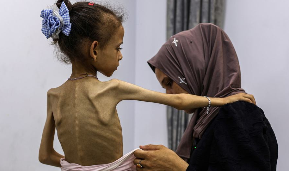 No Holocausto palestino, a fome como arma do Estado racista de Israel